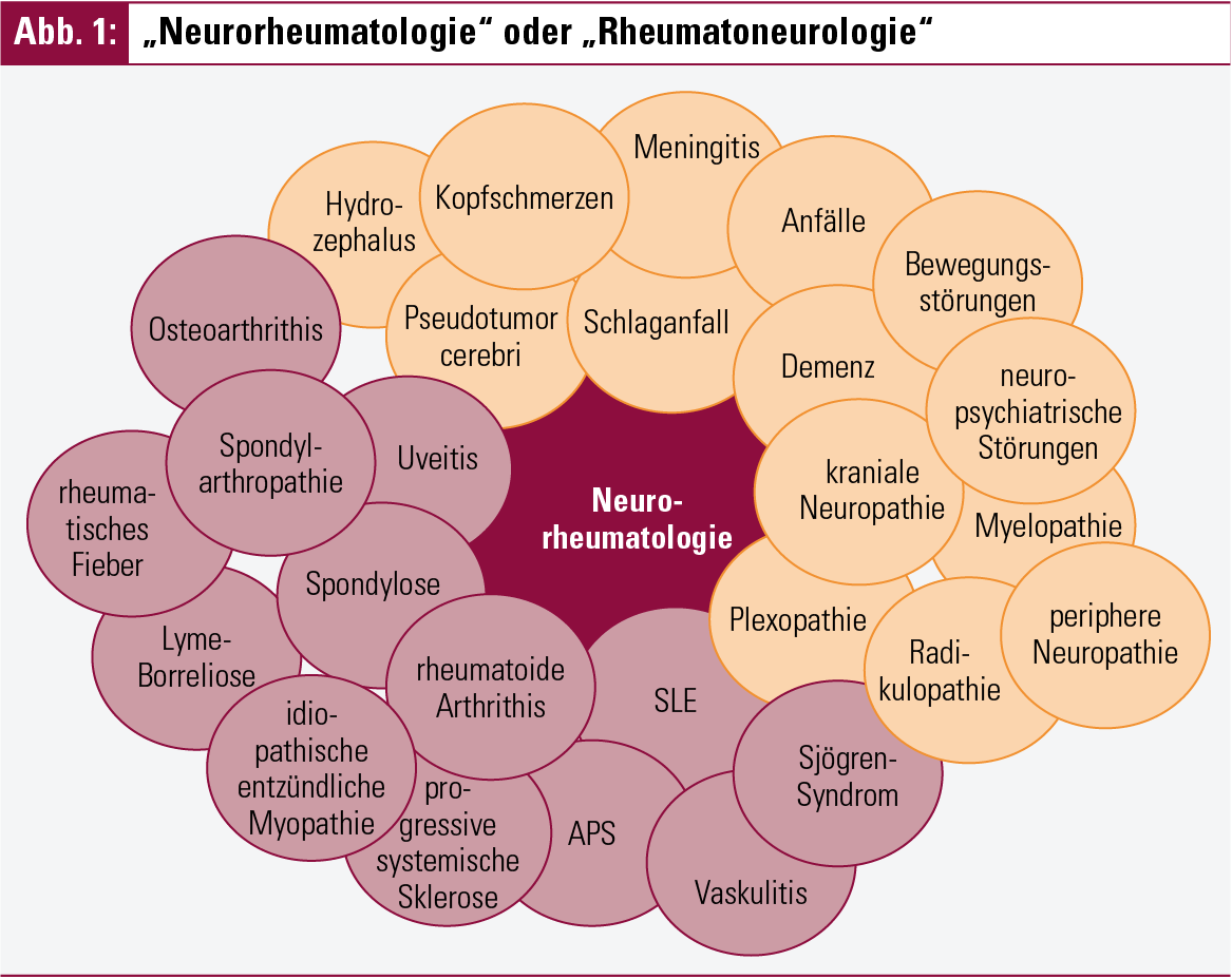 Neurologische Erkrankung - DrBeckmann